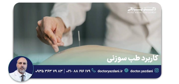 کاربرد طب سوزنی